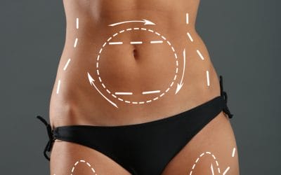 Body Contouring Options in Columbus, OH: Non-Surgical vs. Surgical Treatments